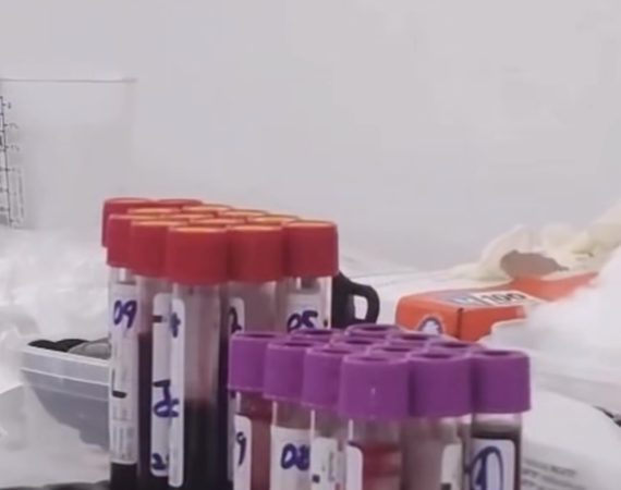 Prefeitura de Brejo Grande descentraliza atendimento de saúde com coleta mensal de exames em Saramém