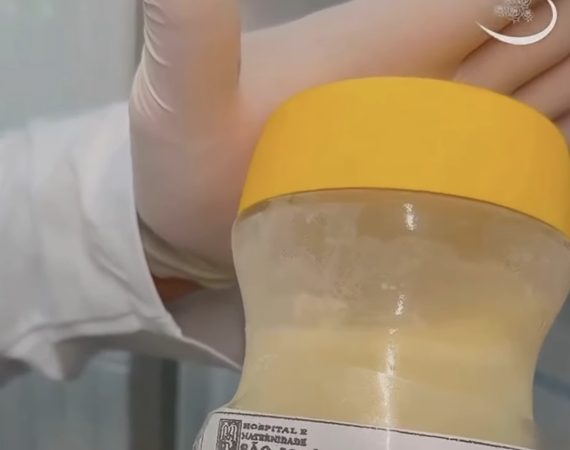 Leite materno excedente pode alimentar bebês internados e Hospital Santa Isabel orienta mães interessadas em doar